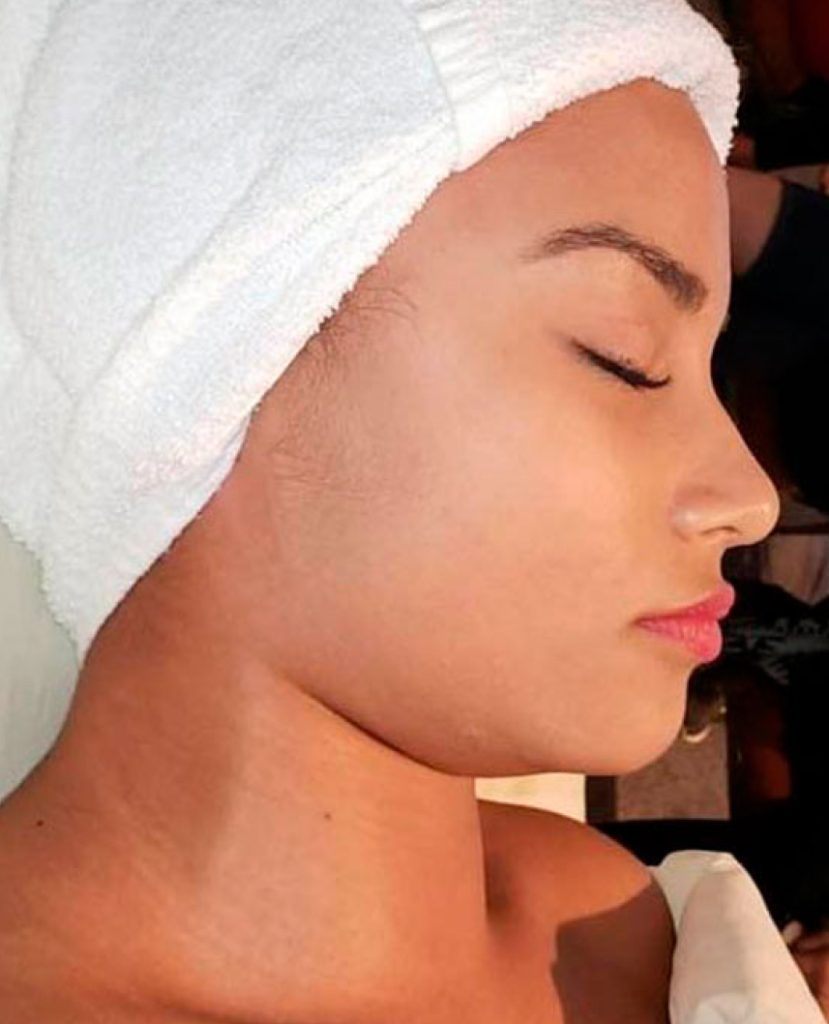 alternative à la chirurgie esthétique renata frança miracle face pour une apparence jeune.