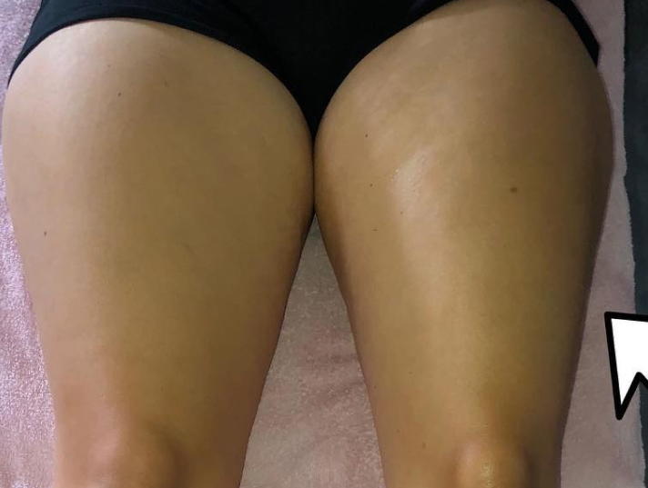 massage remodelant renata frança, bien être et détoxification.